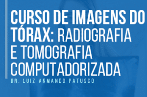 imagens do torax radio tomo 1 300x198 - Curso de imagens do tórax